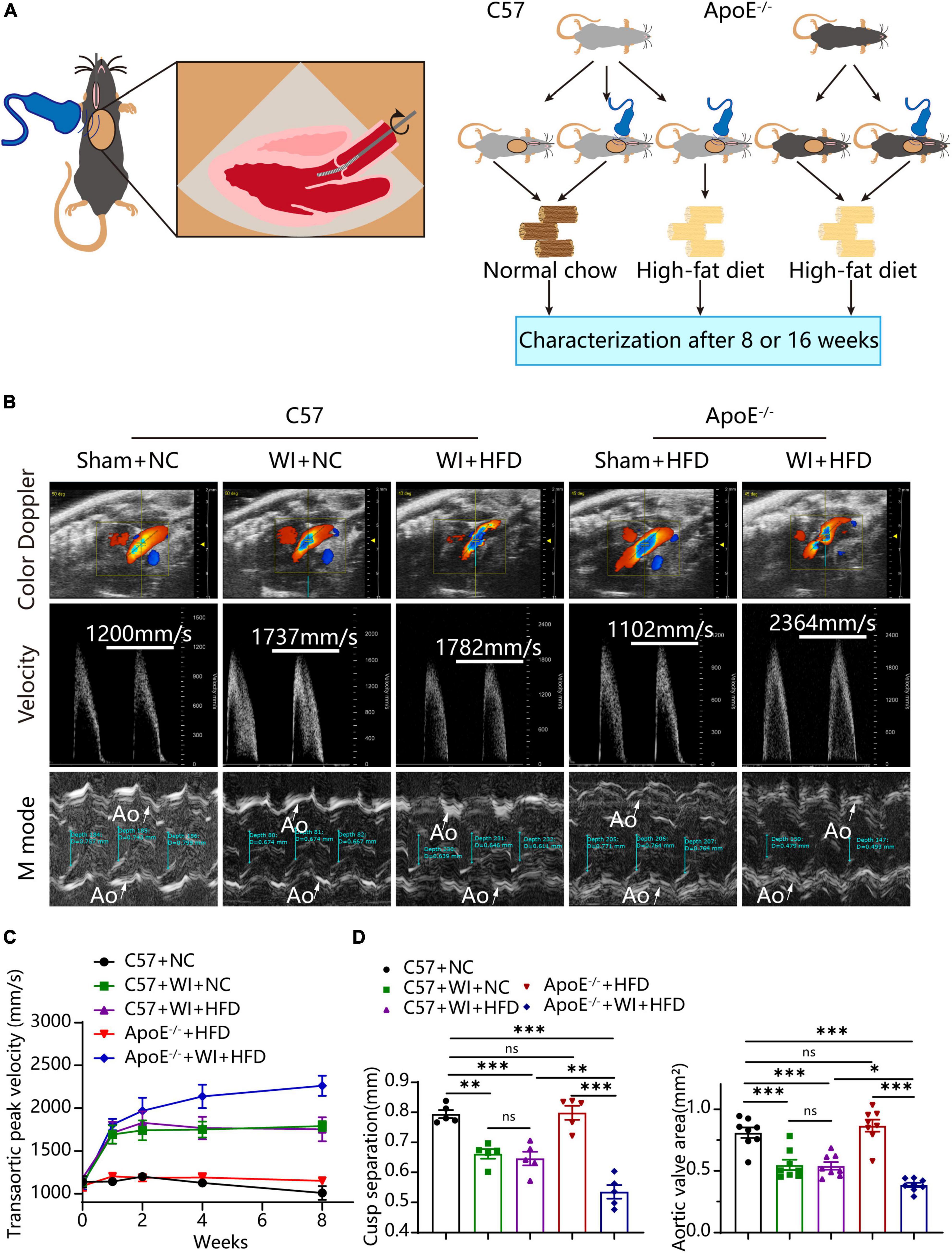 Mechanical injury accentuates lipid deposition in ApoE–/– mice and advance aortic valve stenosis: A novel modified aortic valve stenosis model
